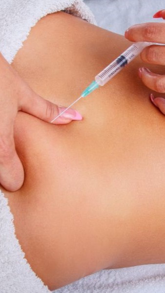 20122024-mesoterapia-ME-corporal Mesoterapia en la espalda