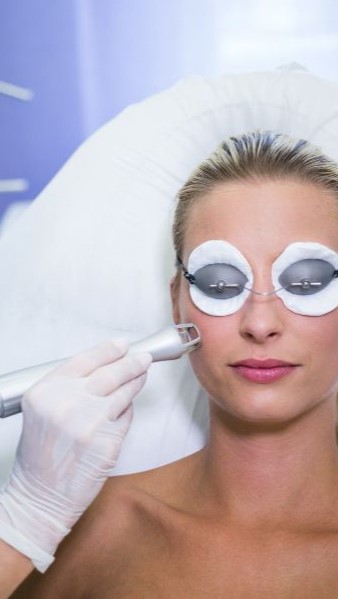 20122024-rejuvencimientoLaser-ME-facial Se le aplica el tratamiento laser