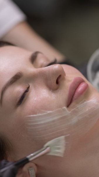 201224-peelingquimico-ME-facial Restriega el proceso de peeling en la cara