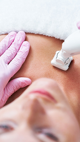 Microneedling Microneedling